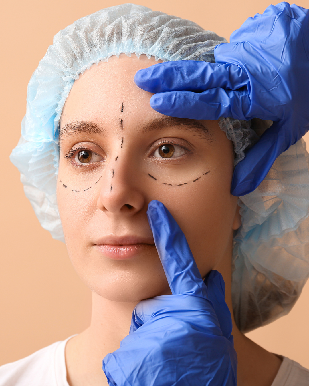 Blepharoplasty