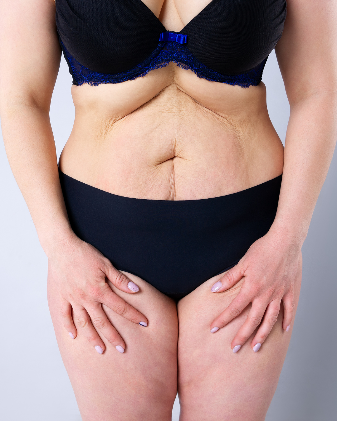 Vaginal Reconstruction