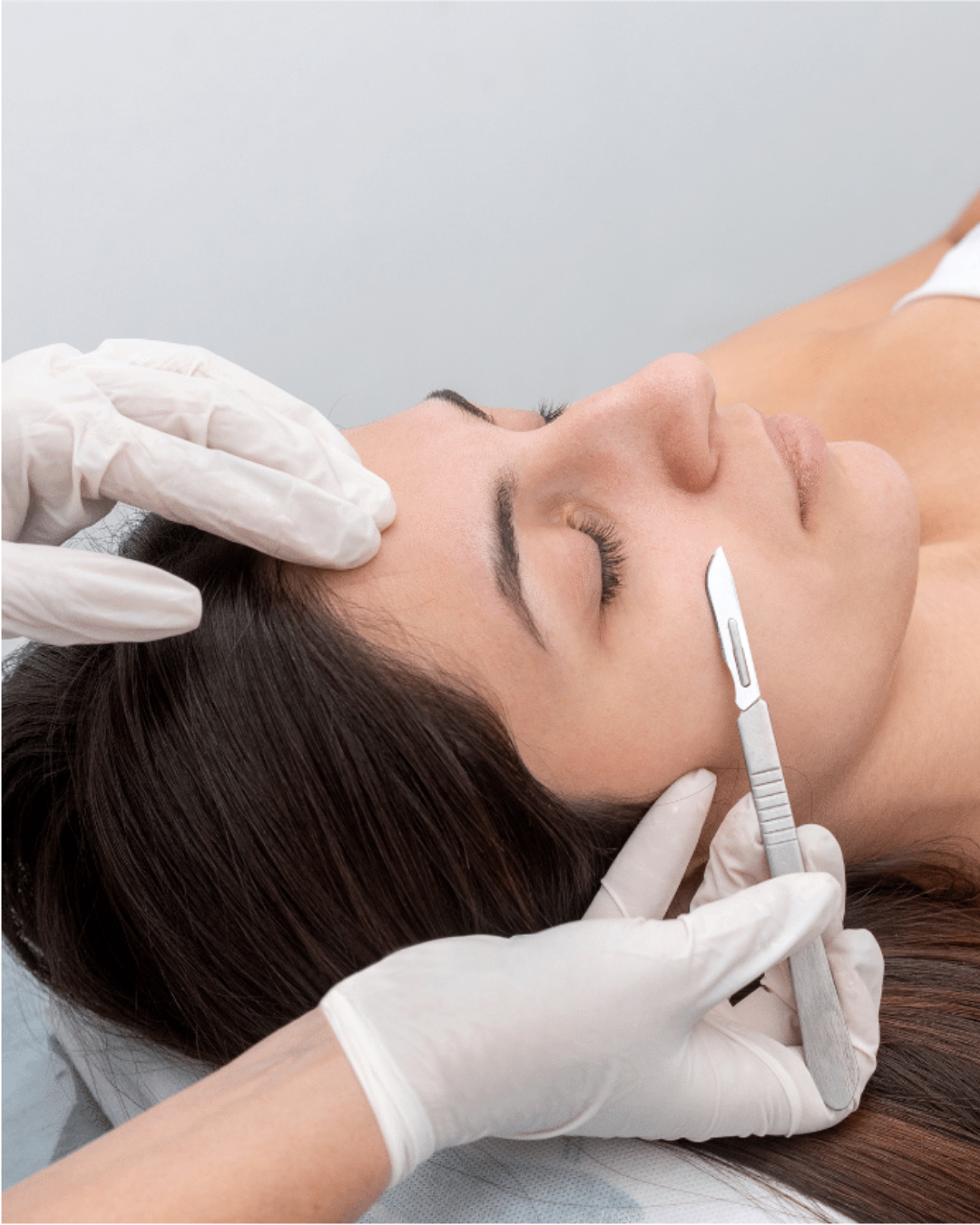 Dermaplaning