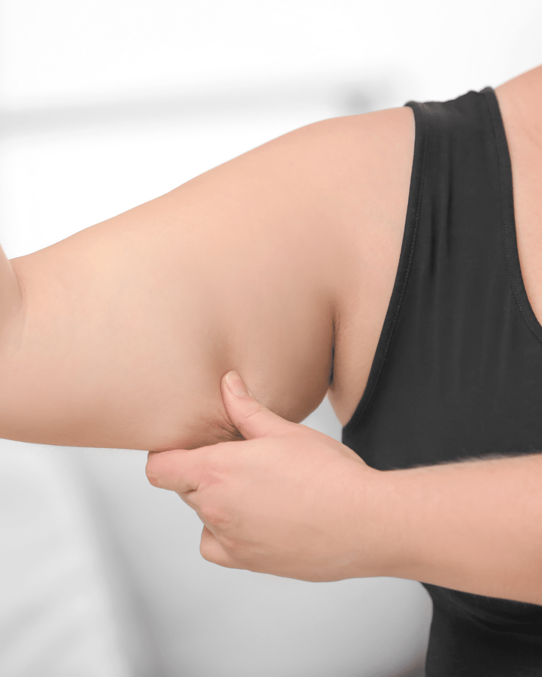 Brachioplasty