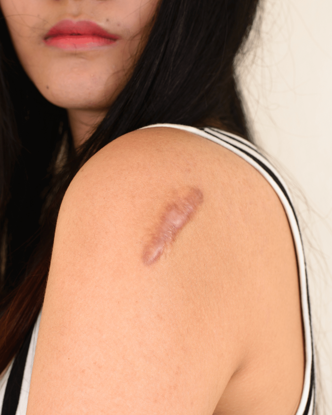 Skin Procedures in Bloomfield Hills, MI