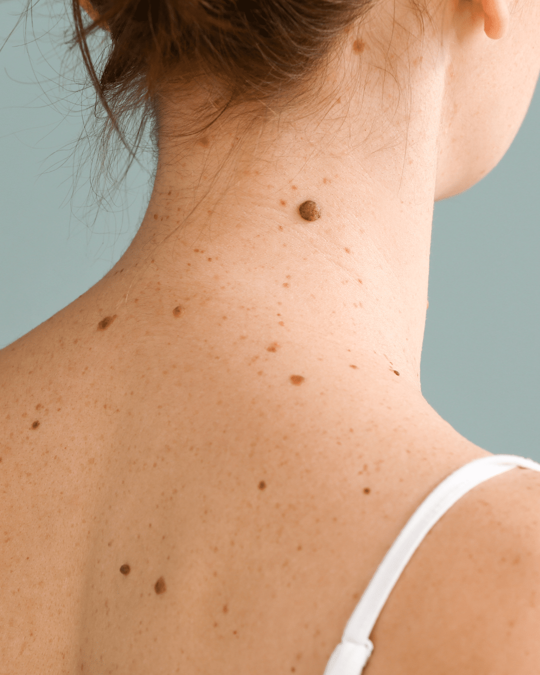Skin Procedures in Bloomfield Hills, MI
