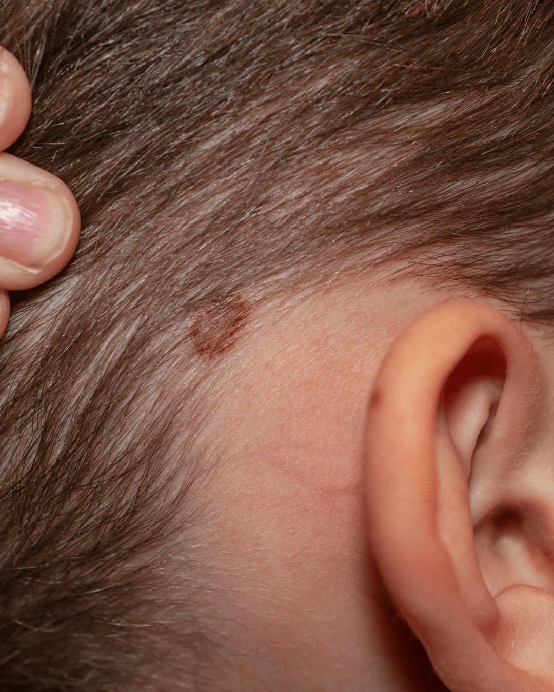 Skin Procedures in Bloomfield Hills, MI