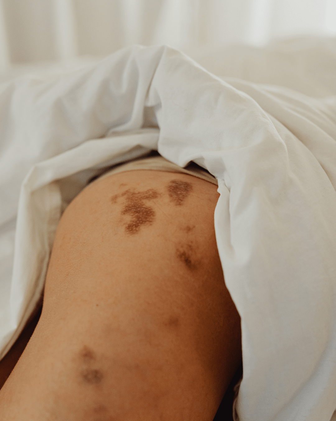 Skin Procedures in Bloomfield Hills, MI