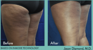 Evolve Treatments in Bloomfield, MI