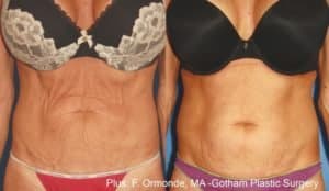 Evolve Treatments in Bloomfield, MI