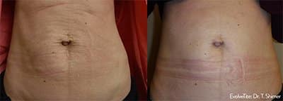 Evolve Treatments in Bloomfield, MI