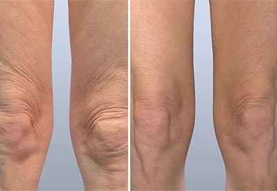 Evolve Treatments in Bloomfield, MI
