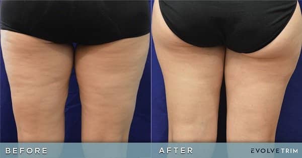 Evolve Treatments in Bloomfield, MI