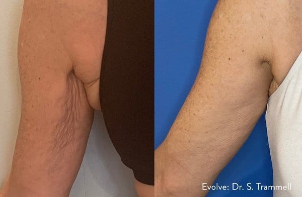 Evolve Treatments in Bloomfield, MI