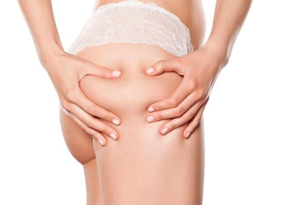 Liposuction in Bloomfield Hills, MI