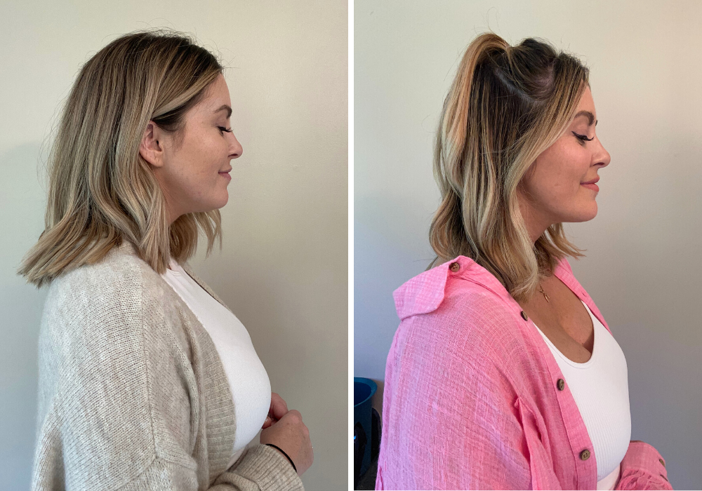 Before and After Image: No case title - right-side
